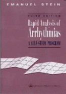 Rapid Analysis of Arrhythmias: A Self-Study Program