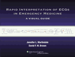 Rapid Interpretation of ECGs in Emergency Medicine: A Visual Guide