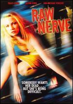 Raw Nerve