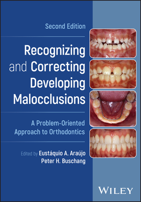 Recognizing and Correcting Developing Malocclusions: A Problem-Oriented Approach to Orthodontics - Ara�jo, Eust�quio A. (Editor), and Buschang, Peter H. (Editor)