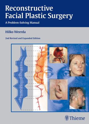 Reconstructive Facial Plastic Surgery: A Problem-Solving Manual - Weerda, Hilko