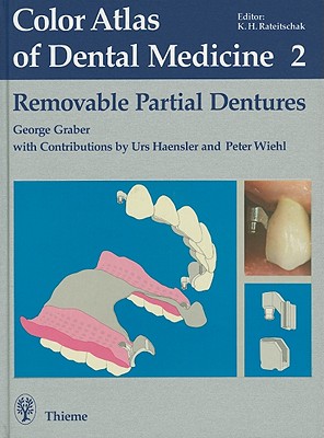 Removable Partial Dentures - Graber, George, and Jacobi, R. (Translated by)