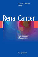 Renal Cancer: Contemporary Management