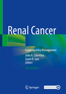 Renal Cancer: Contemporary Management