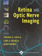 Retina and Optic Nerve Imaging
