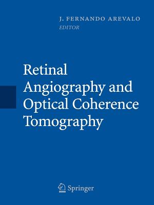 Retinal Angiography and Optical Coherence Tomography - Ar�valo, J Fernando (Editor)