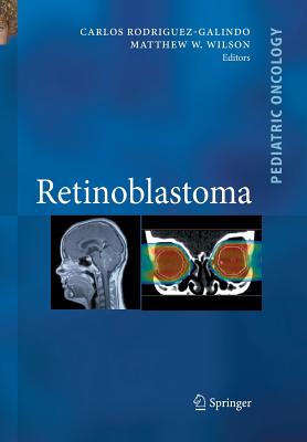Retinoblastoma - Rodriguez Galindo, Carlos (Editor), and Wilson, Matthew W (Editor)