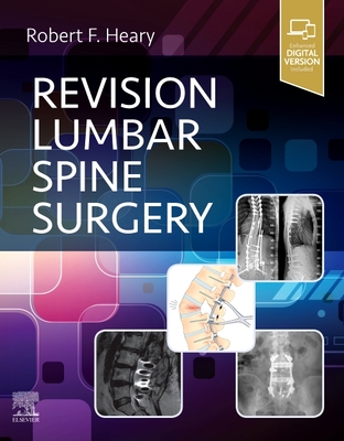 Revision Lumbar Spine Surgery - Heary, Robert F., MD (Editor)