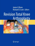 Revision Total Knee Arthroplasty
