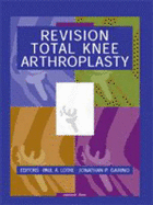 Revision Total Knee Arthroplasty