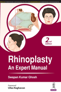 Rhinoplasty: An Expert Manual