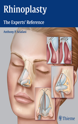 Rhinoplasty: The Experts' Reference - Sclafani, Anthony P (Editor)