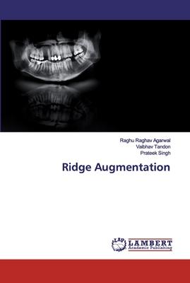 Ridge Augmentation - Agarwal, Raghu Raghav, and Tandon, Vaibhav, and Singh, Prateek