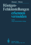 Rontgen-Fehleinstellungen: Erkennen Und Vermeiden