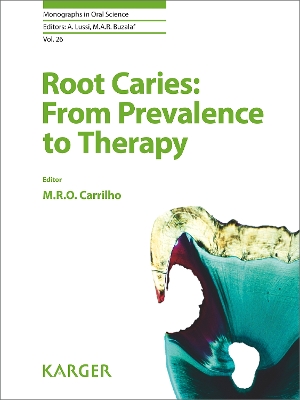 Root Caries: From Prevalence to Therapy - Rocha de Olivera Carrilho, M. (Editor), and Lussi, Adrian (Series edited by), and Buzalaf, Marilia A.R. (Series edited by)