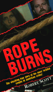 Rope Burns