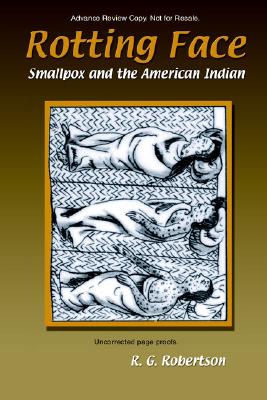 Rotting Face: Smallpox and the American Indian - Robertson, Roland G