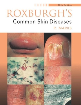 Roxburgh's Common Skin Diseases - Marks, Ronald, Frcp