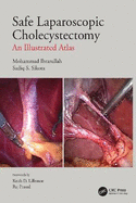 Safe Laparoscopic Cholecystectomy: An Illustrated Atlas