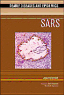 Sars