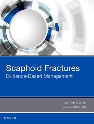 Scaphoid Fractures: Evidence-Based Management - Buijze, Geert Alexander, MD, PhD, and Jupiter, Jesse B, MD