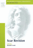 Scar Revision