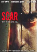 Scar - Rahil Bhorania