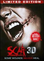 Scar