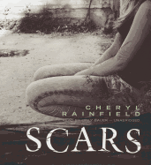 Scars