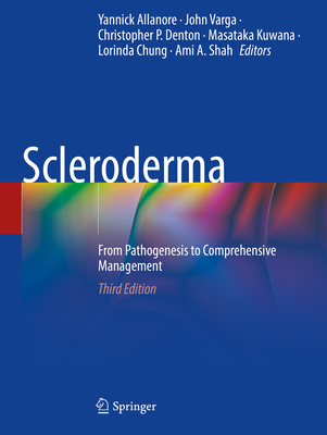 Scleroderma: From Pathogenesis to Comprehensive Management - Allanore, Yannick (Editor), and Varga, John (Editor), and Denton, Christopher P. (Editor)