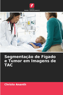 Segmenta??o de F?gado e Tumor em Imagens de TAC