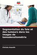 Segmentation du foie et des tumeurs dans les images de tomodensitom?trie