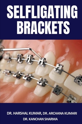 Selfligating Brackets - Harshal, Dr.