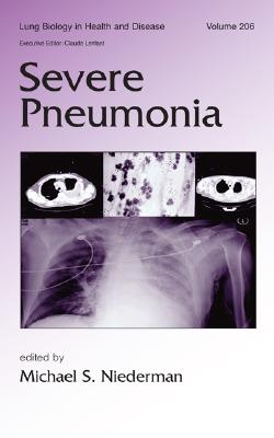Severe Pneumonia - Niederman, Michael S (Editor)