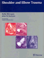 Shoulder and Elbow Trauma
