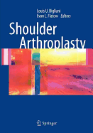 Shoulder Arthroplasty