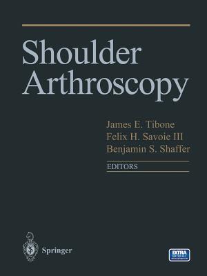 Shoulder Arthroscopy - Tibone, James (Editor), and Savoie, Felix H. III (Editor), and Shaffer, Benjamin (Editor)