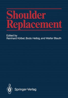 Shoulder Replacement - K�lbel, Reinhard (Editor), and Telger, Terry C (Translated by), and Helbig, Bodo (Editor)