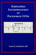 Simplified Interpretation of Pacemaker Ecgs