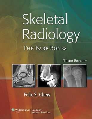 Skeletal Radiology: The Bare Bones - Chew, Felix S