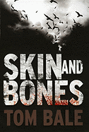 Skin and Bones