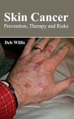 Skin Cancer: Prevention, Therapy and Risks - Willis, Deb (Editor)