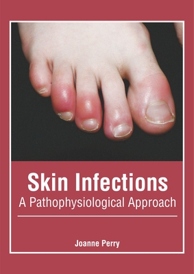 Skin Infections: A Pathophysiological Approach - Perry, Joanne (Editor)