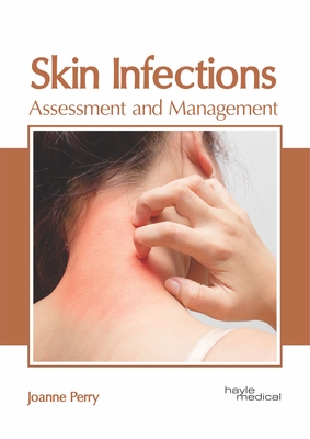 Skin Infections: Assessment and Management - Perry, Joanne (Editor)