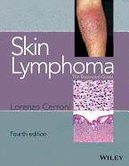 Skin Lymphoma: The Illustrated Guide