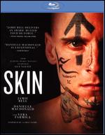 Skin - Guy Nattiv