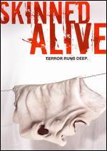Skinned Alive