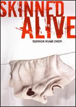 Skinned Alive - James Tucker