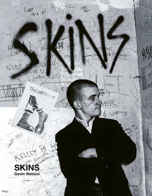 Skins: Gavin Watson - Watson, Gavin