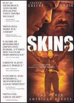 Skins - Chris Eyre